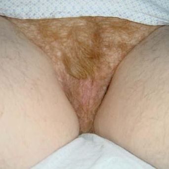 Fempie